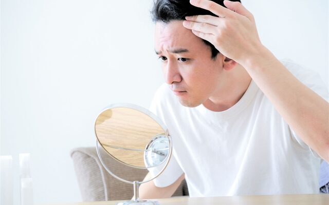 薄毛・AGA傾向